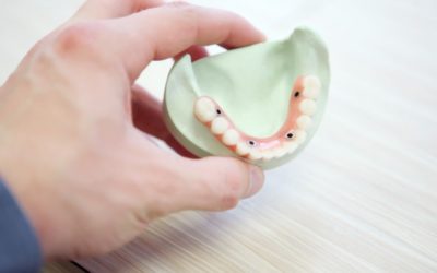 All-on-four teeth