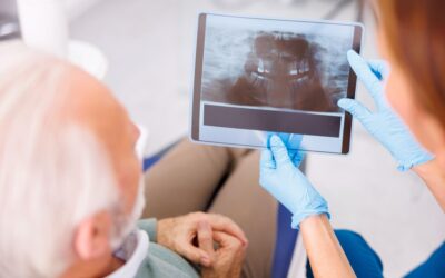 Dentist showing jaw x-ray to patient
